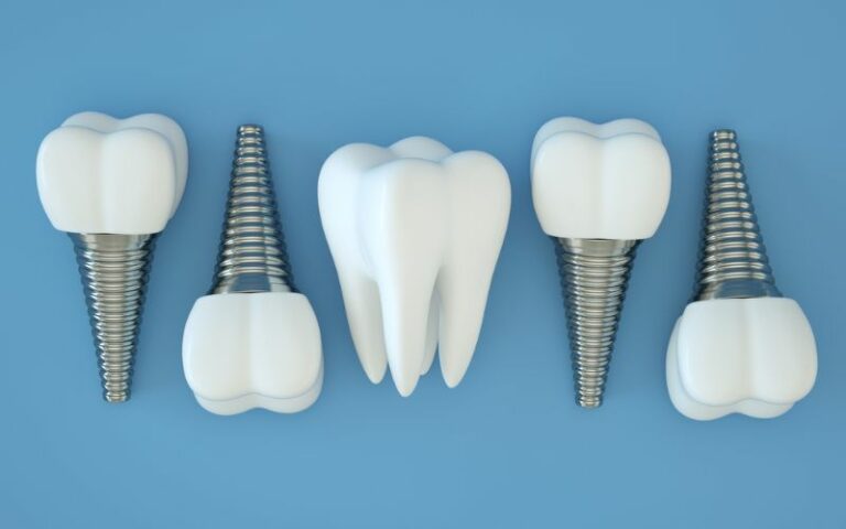 Dental implants lined up next to each other on a blue background for presentation