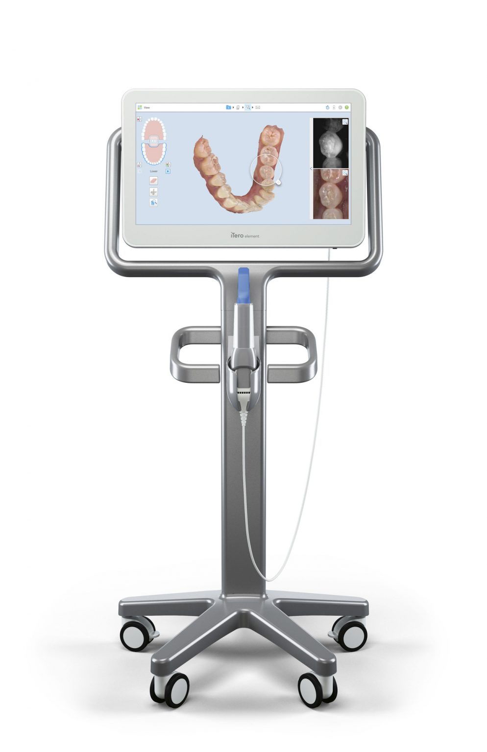 Itero—digital Intraoral Scanner Long Beach Dental Health 9546