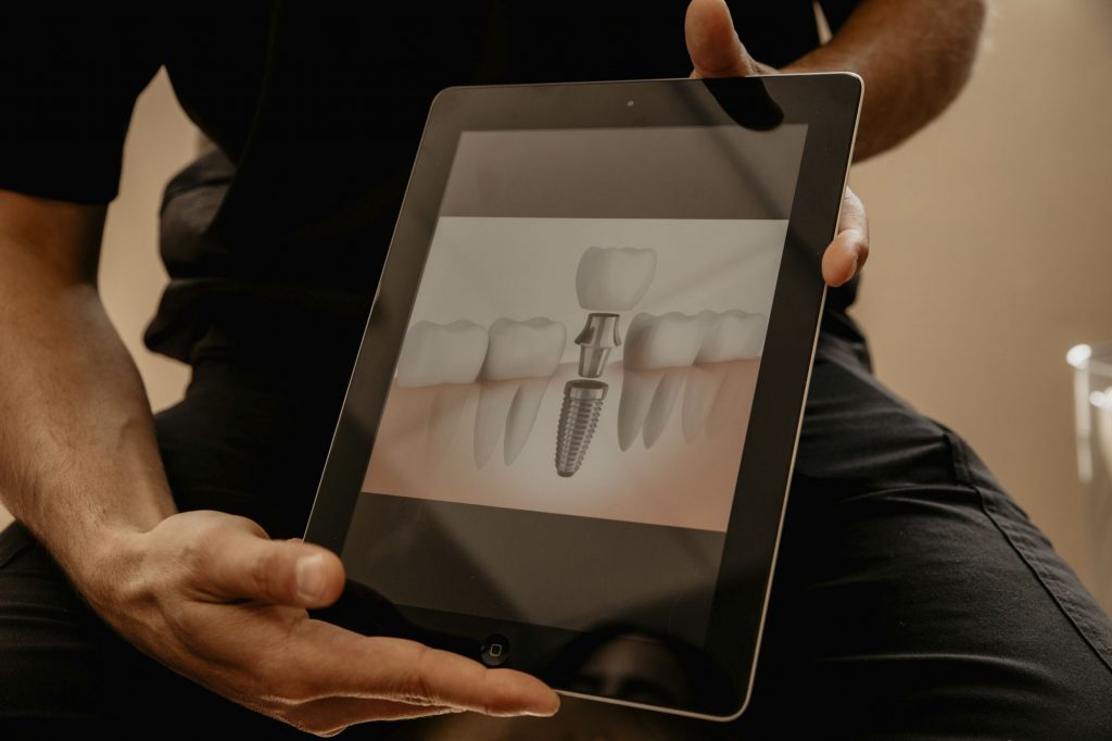 an illustration of a dental implant displayed on an ipad